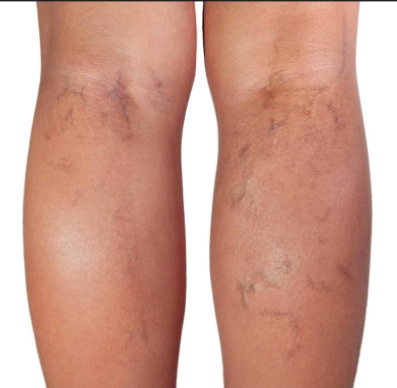 Firming & Tightening Face and Body Serum
